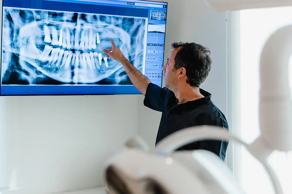 Imagem de planejamento digital do tratamento com implantes