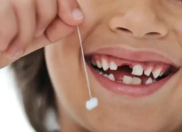 Extrações Dentárias