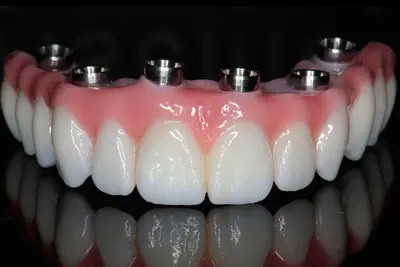 Conforto e experiência do paciente